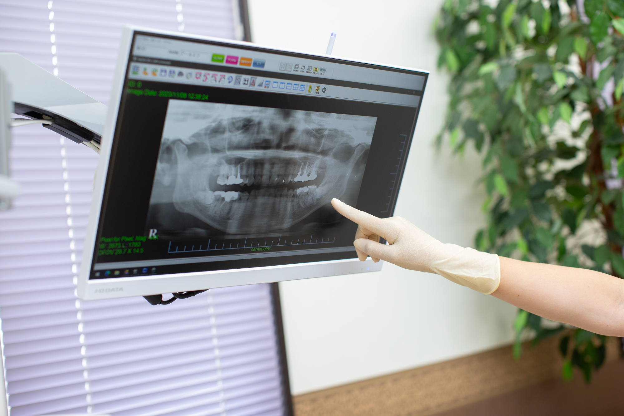 モニター付き診療ユニット