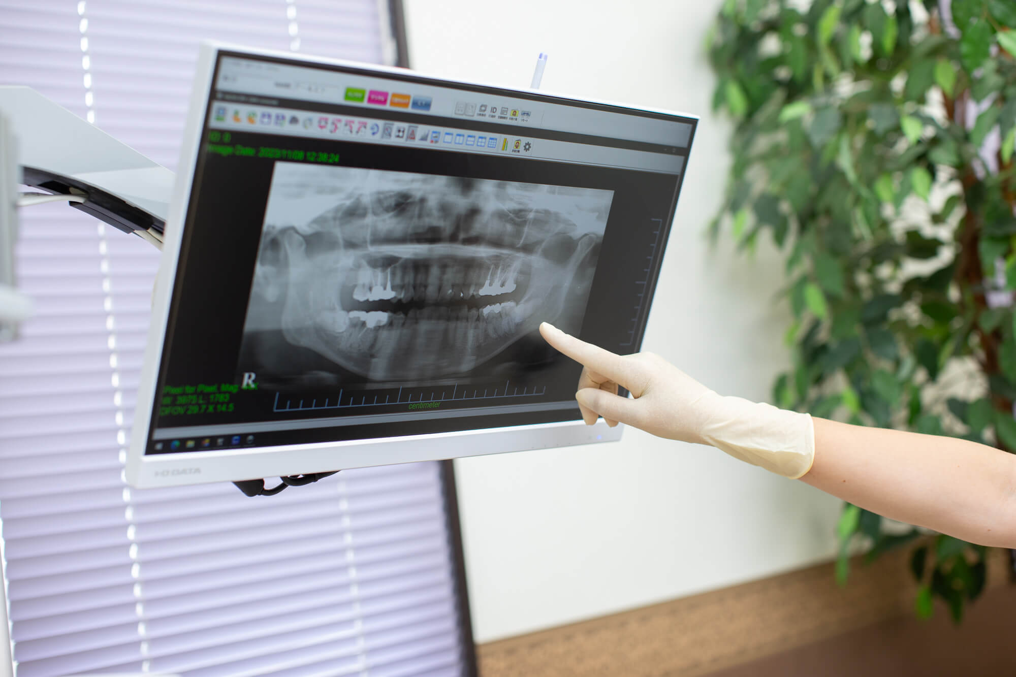 モニター付き診療ユニット